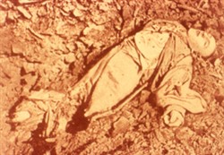 Slide of a photograph of corpse